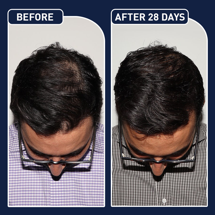 FEG PLUS HAIR SPRAY - سبراي الشعر FEG PLUS